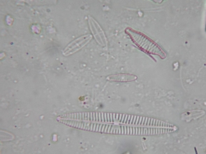 Diatomee bentoniche fluviali, visione al microscopio (ingrandimento 1000X).
